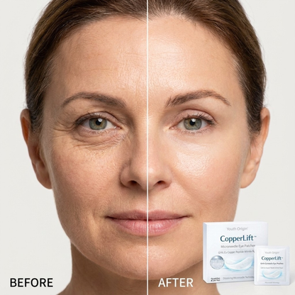 CopperLift Microneedle Eye Patches