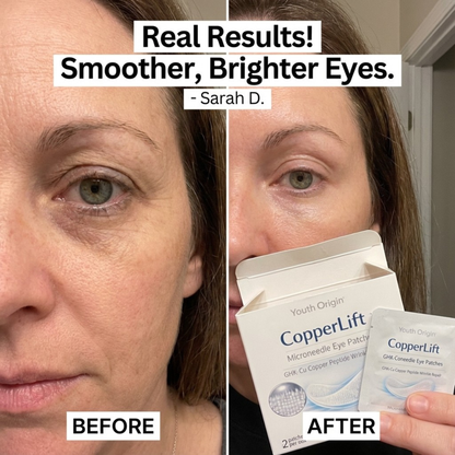CopperLift Microneedle Eye Patches