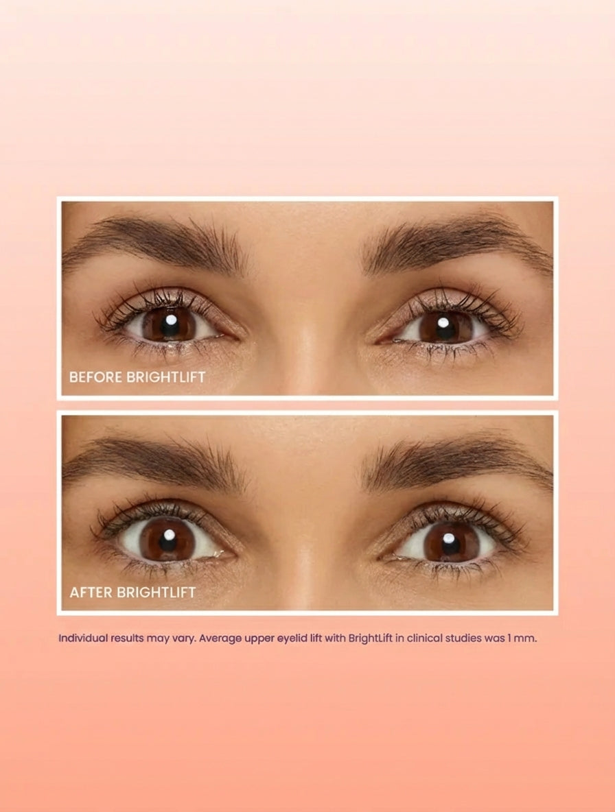 Brightlift