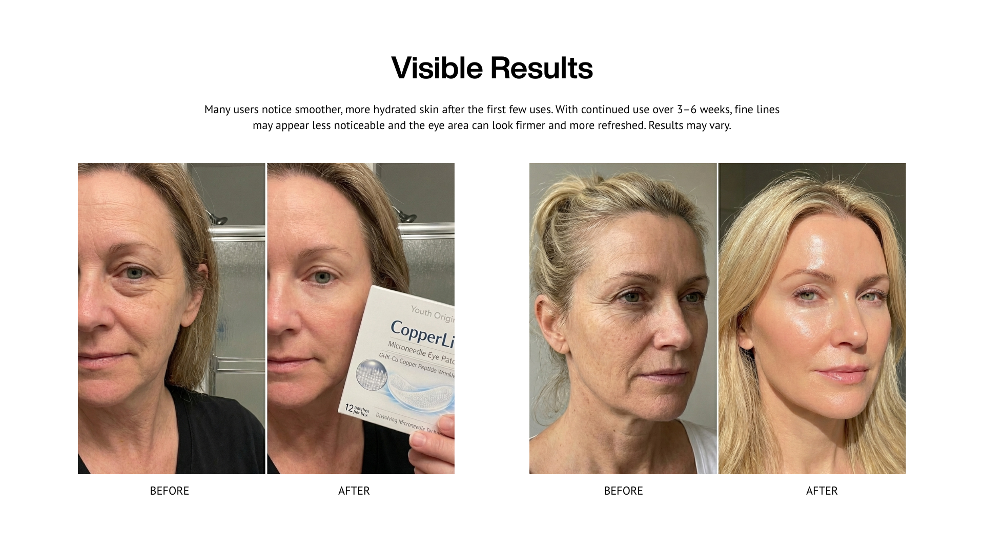 CopperLift Microneedle Eye Patches